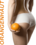 Hilft Sport gegen Cellulite?