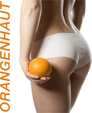 Hilft Sport gegen Cellulite?